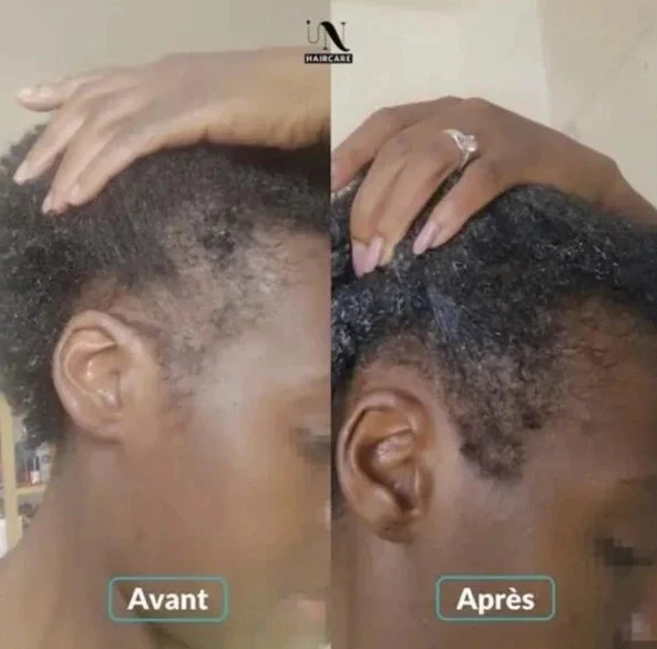Gélules Pousse Cheveux Cure 3 Mois - In Haircare 2 Gélules Pousse Cheveux Cure 3 Mois - In Haircare – Image 2