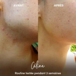 Masque Visage Purifiant En Poudre BIO - WAAM 5 Masque Visage Purifiant En Poudre BIO - WAAM -Invisibobble® Magasin masque visage purifiant avant apres waam